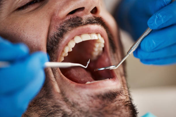 Best Emergency Gum Treatment in Ladera, CA
